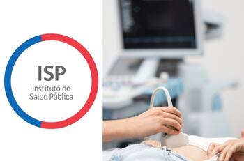 ISP emite alerta por este aparato médico que puede afectar a mujeres embarazadas