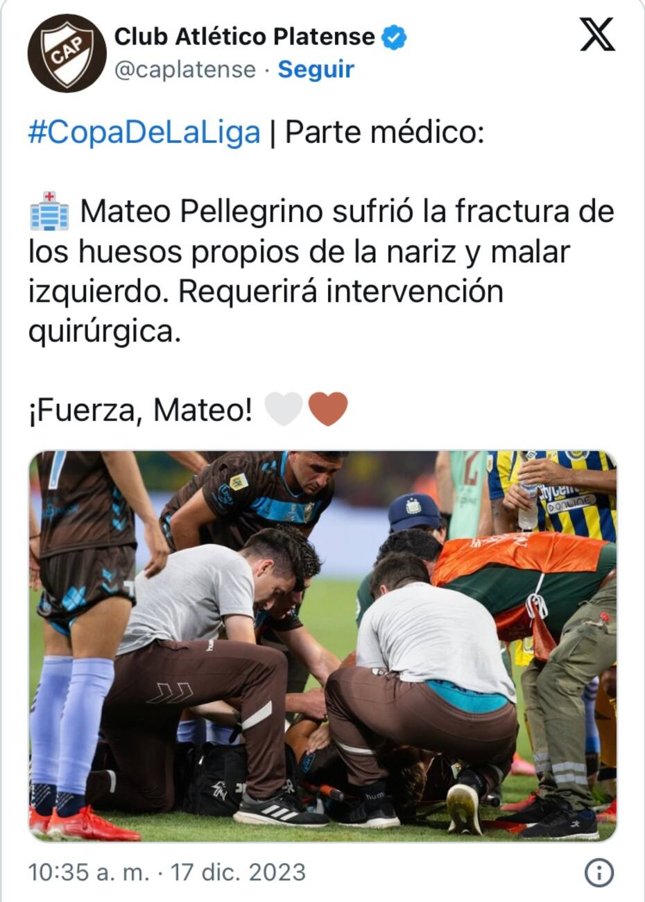 Comunicado Club Atlético Platense sobre Mateo Pellegrino.