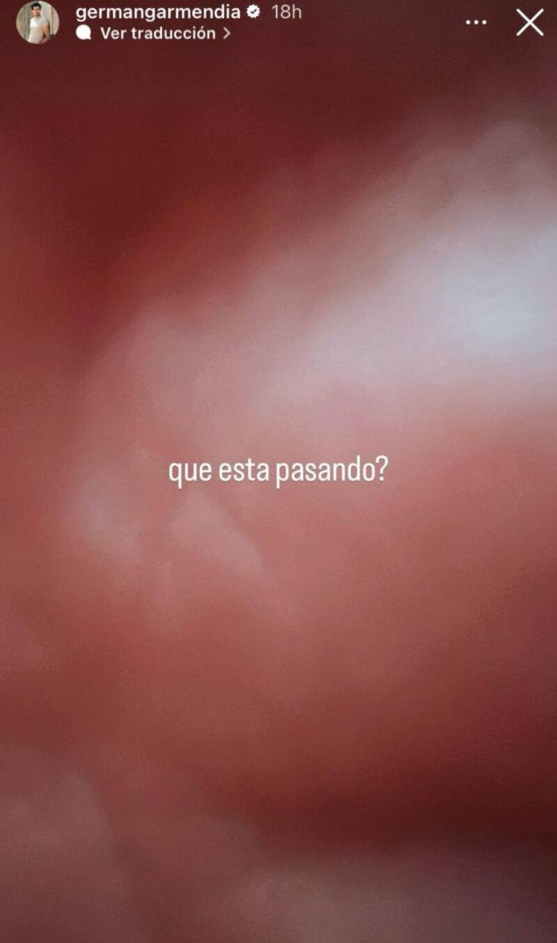 Germán Garmendia reaccionó ante pérdida de millones de seguidores.