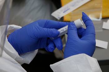 Reportan primer caso de chileno contagiado con viruela del mono en Europa: Se encuentra aislado en Italia