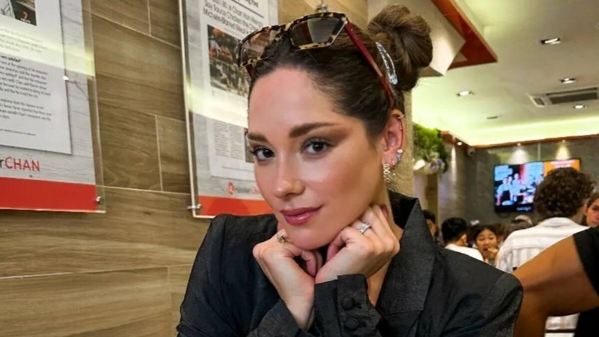 "No tengo problema": Kel Calderón explicó el tratamiento estético que se realizó en su rostro