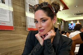 "No tengo problema": Kel Calderón explicó el tratamiento estético que se realizó en su rostro