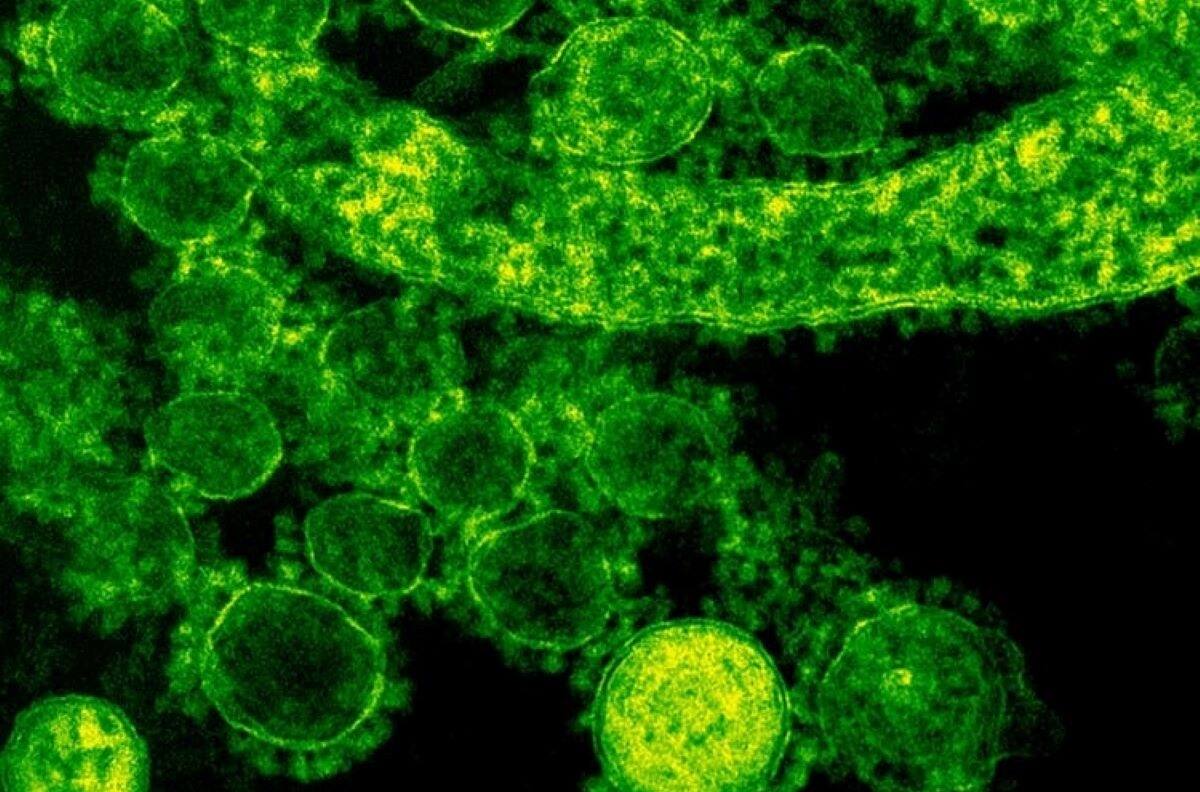 Virus de Marburgo: ¿Cómo se trasmite y cuáles son los síntomas de esta enfermedad similar al Ébola?