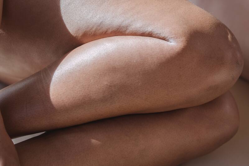 Cambia de hábitos y mejora la circulación en la sangre.