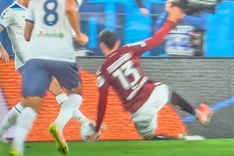 tuvo esta mano en el Torino.