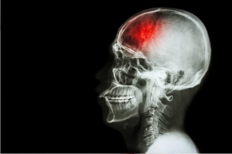 Revisa cuál es e producto que puede dañar tu salud.