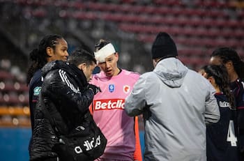 Tiane Endler sufrió duro golpe en Francia y tuvieron que ponerle puntos: así le quedó el rostro