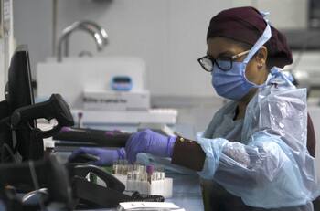 OMS descartó el origen del Covid-19 en un laboratorio y posterior propagación: Se barajan teorías