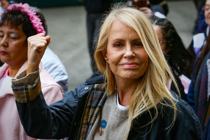 La modelo es activa por los derechos de las personas con cáncer. Edwin Navarro/Aton Chile