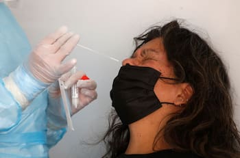 Informe Covid 19: Minsal reportó hoy martes la cifra más baja de casos nuevos desde el 23 de enero