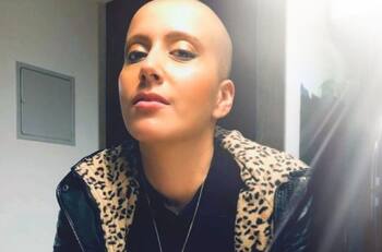 "Mi esencia sigue igual, feliz y positiva con cada paso": Mila Correa comparte potente reflexión en su lucha contra el cáncer y agradece a sus seguidores