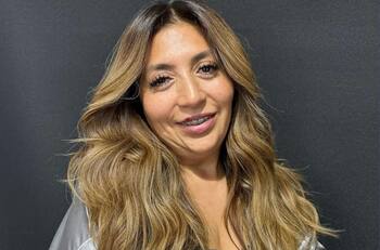 “Es impresionante el cambio”: Pincoya revela detalles sobre su nuevo procedimiento estético