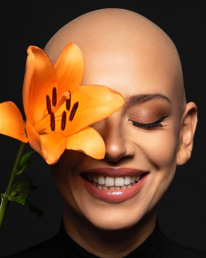 La actriz muestra con orgullo su calvicie. (Créditos: @KarlaMelo)