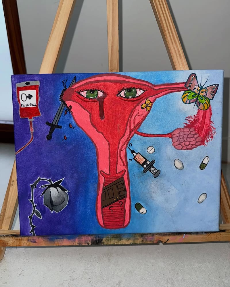 La artista argentina compartió el impactante cuadro que relata el dolor que ha vivido durante las últimas semanas.