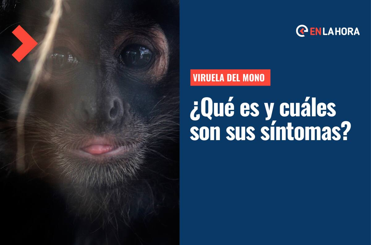 Viruela del Mono: ¿Qué es, cuáles son sus síntomas y qué se está haciendo en Chile ante la enfermedad?