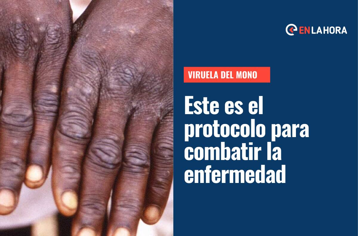 Viruela del mono: Revelan protocolo de acción y qué hacer si te contagias