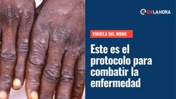 Viruela del mono: Revelan protocolo de acción y qué hacer si te contagias