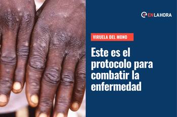 Viruela del mono: Revelan protocolo de acción y qué hacer si te contagias