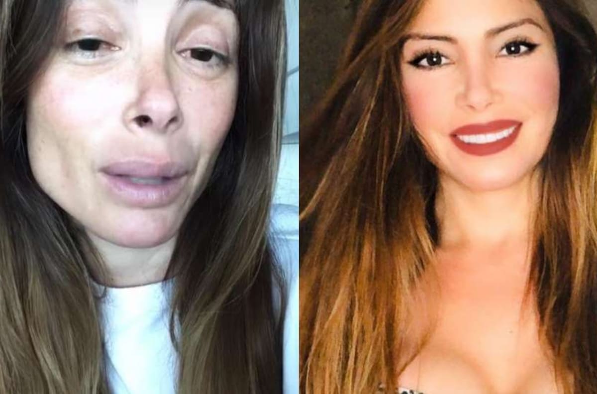 Colegio de Nutricionistas denunció a Roxana Muñoz por su ayuno de 21 días