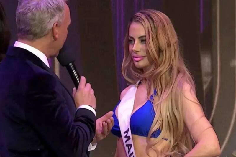 respondió a los rumores de arreglo estético.