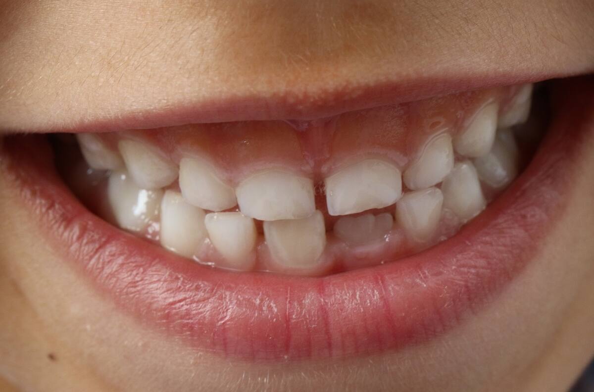 Cientos de dientes humanos llueven sobre un hombre que arreglaba el techo de una tienda en Estados Unidos