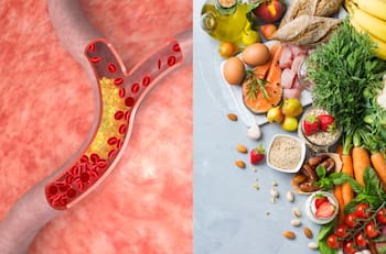 Esta es la mejor dieta para disminuir los niveles de colesterol, según Harvard