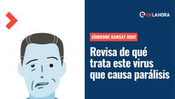 ¿Qué es el síndrome de Ramsay Hunt? Conoce los síntomas del virus que puede causar parálisis facial