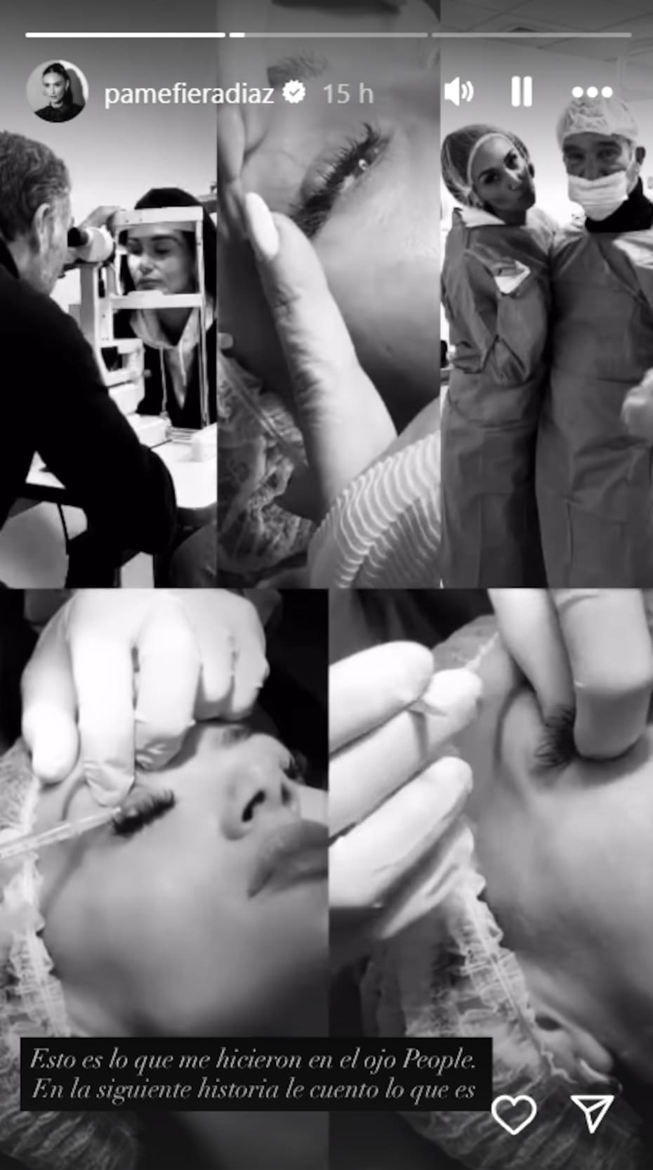 A la fiera le extrajeron quirúrgicamente la protuberancia en su párpado.