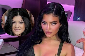 Kylie Jenner niega haberse hecho cirugías para cambiar la apariencia de su rostro