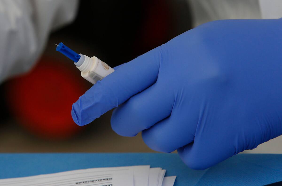 Estudio detecta que el Covid-19 genera sordera en sus pacientes