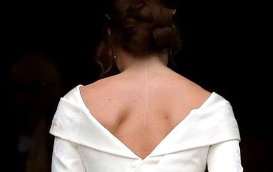 La princesa Eugenia mostrando con orgullo su cicatriz en su traje de boda