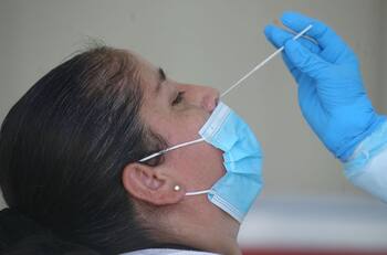 Balance Minsal: Conoce el número de casos positivos y fallecimientos por Covid-19 registrados este domingo