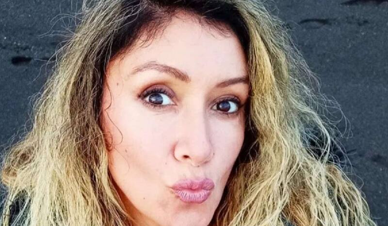 realiza potente reflexión sobre la alopecia.