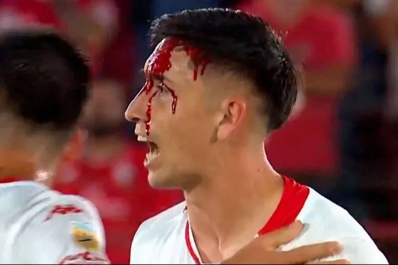 ensangrentado tras una refriega con un futbolista de San Lorenzo.