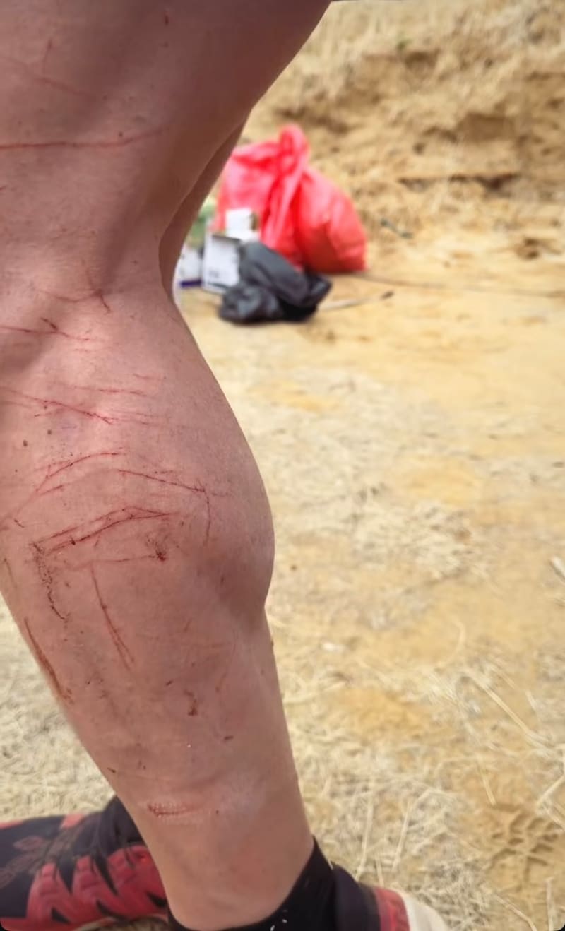 El influencer mostró impactantes lesiones en la semifinal de Palabra de Honor.