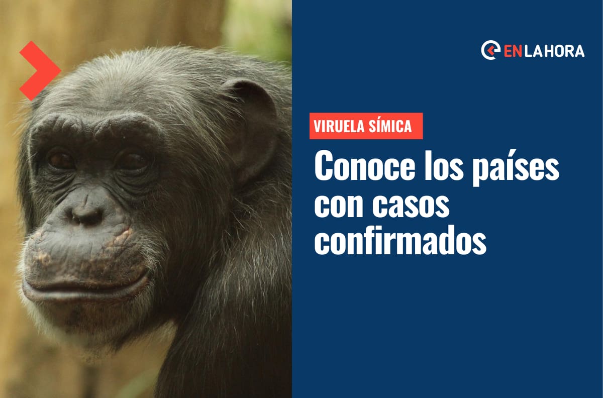 Viruela del Mono cada vez más cerca de Chile: Estos son los países con casos confirmados