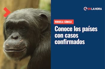 Viruela del Mono cada vez más cerca de Chile: Estos son los países con casos confirmados