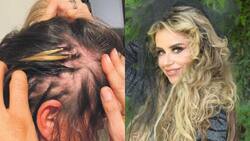 ¿Qué es la Alopecia? El trastorno que afecta a Amanda Cibely, ex chica “Mekano”