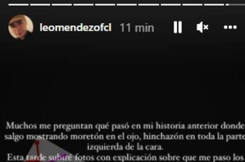 "Hasta hoy sufro de dolores": Leo Méndez Junior el problema que sufrió en su última visita a Chile