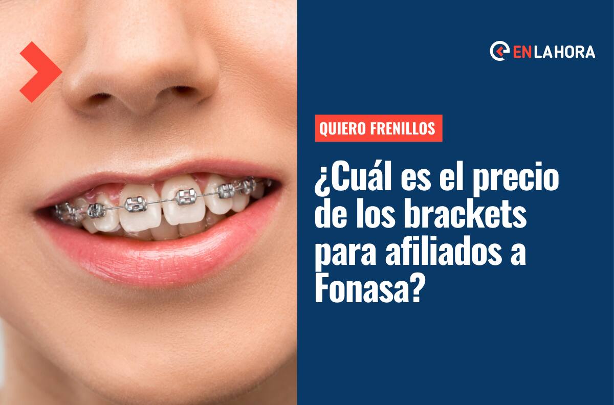 "Quiero Frenillos": ¿Cuál es el precio de los brackets para niños y adultos afiliados a Fonasa?