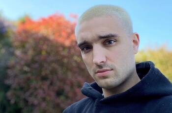 Tom Parker, integrante de "The Wanted", reveló que padece un tumor cerebral terminal