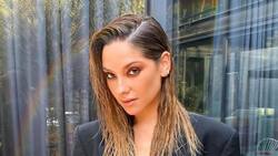 Kel Calderón mostró la lesión en su brazo que le dejó la vacuna en contra del Covid-19