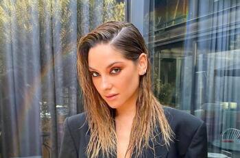 Kel Calderón mostró la lesión en su brazo que le dejó la vacuna en contra del Covid-19