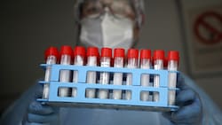 Informe Covid-19: ¿Cuántas muertes y casos nuevos se reportaron este sábado 20 de agosto en Chile?