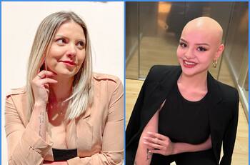 Hija de Nicole Pérez, ex “Mekano”, se postula a Miss Chile tras superar alopecia y una dura adolescencia