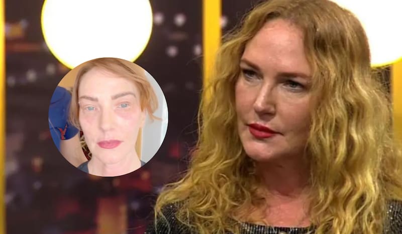 se sometió a drástico cambio estético.