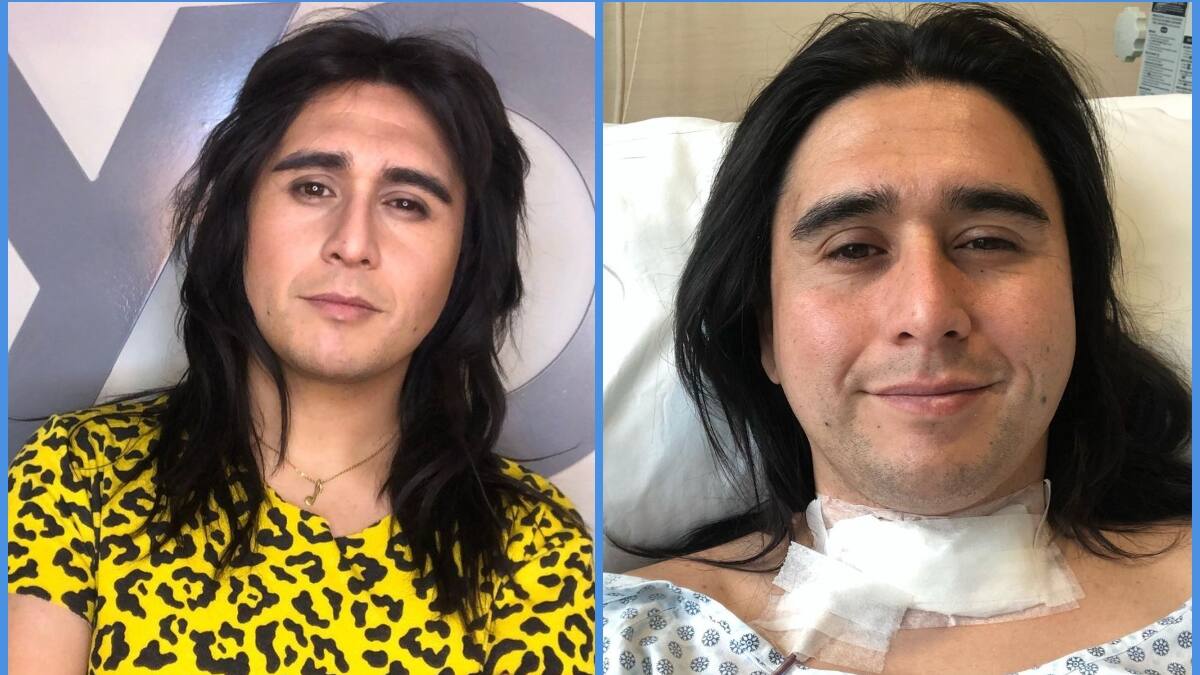 "Un hito importante en mi rehabilitación": Nicolás Cid celebró su regreso al escenario tras someterse a cirugía por un cáncer de tiroides