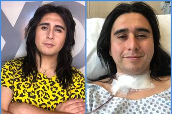 "Un hito importante en mi rehabilitación": Nicolás Cid celebró su regreso al escenario tras someterse a cirugía por un cáncer de tiroides