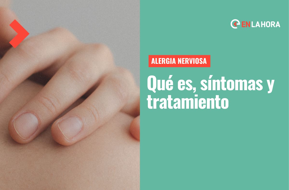 ¿Qué es la alergia nerviosa?: Síntomas y tratamientos para combatirla