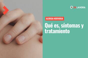 ¿Qué es la alergia nerviosa?: Síntomas y tratamientos para combatirla